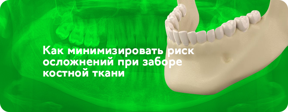 Анализ расположения резцовой петли при планировании забора костного блока в подбородочном отделе нижней челюсти.jpg