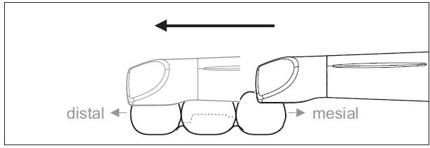 CEREC AC OMNICAM ПРОСТОЕ СКАНИРОВАНИЕ БЕЗ АНТИБЛИКОВОГО СПРЕЯ 0.jpg