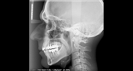 Owandy I-Max Touch 3D Ceph – Конусно-лучевой томограф 9х8