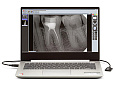 New Life Radiology Mercury DIGISENS - цифровой радиовизиограф с ноутбуком