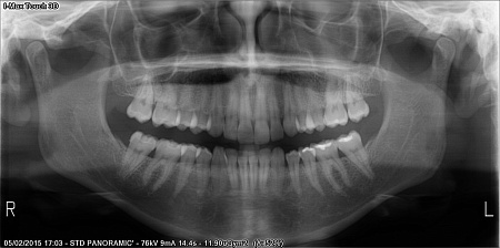 Owandy I-Max Touch 3D Ceph – Конусно-лучевой томограф 9х8