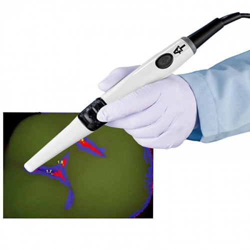 Air Techniques Spectra - оптический детектор кариеса 